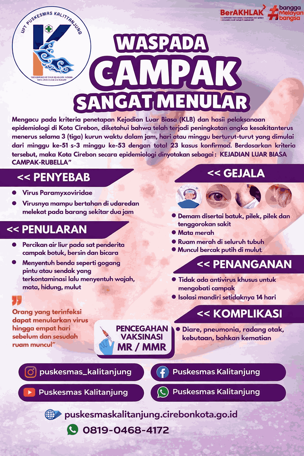 Waspada Campak, Penyakit Sangat Menular